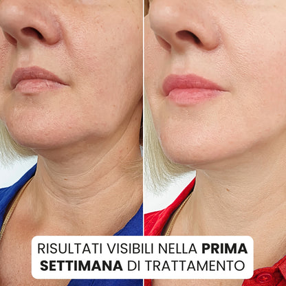 PureHoney® | Trattamento Antirughe