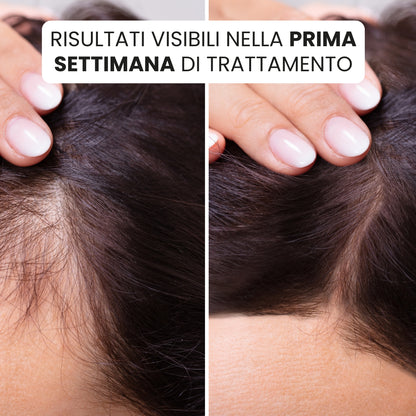 Hair Growth Elixir® | Nutrizione Profonda