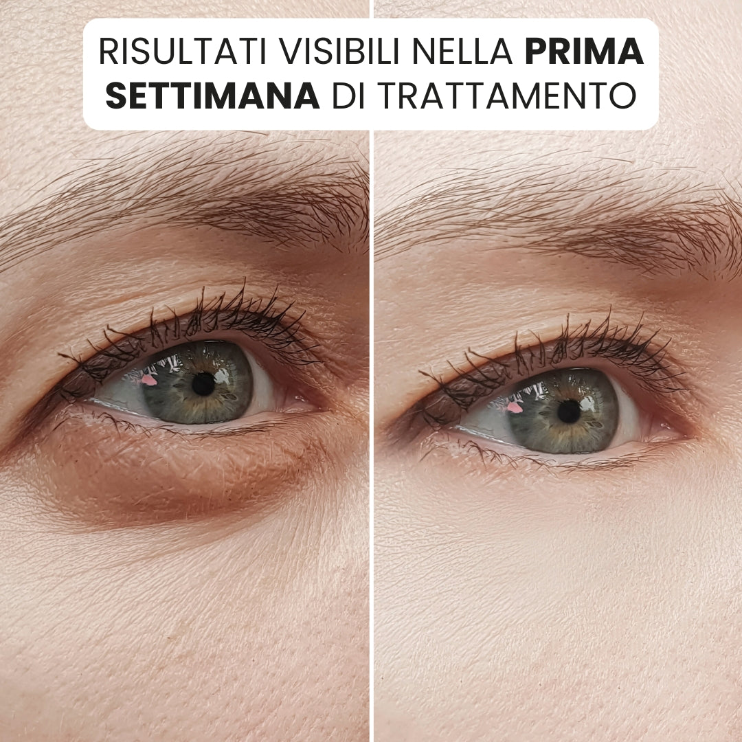 GlowEye® | Patch Illuminanti